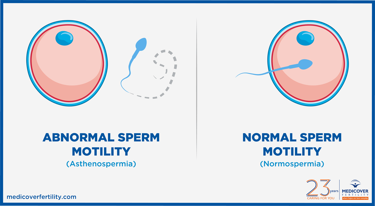 Motility Range Chart